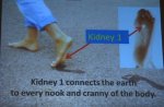 Kidney 1.JPG