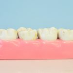 Interconnected Health & the Removal of Wisdom Teeth